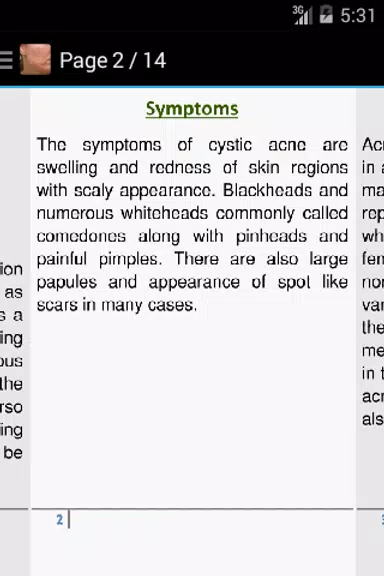 Acne Scar Removal Home Remedy Screenshot 2 