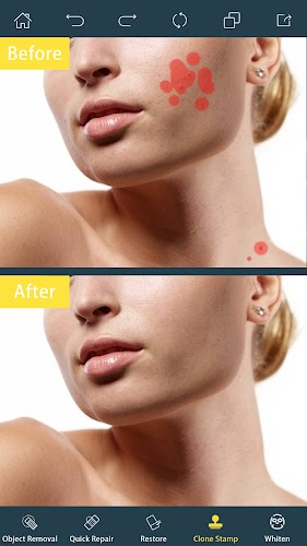 Photo Retouch- Object Removal Screenshot 2