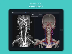Complete Anatomy 2024 Screenshot 23